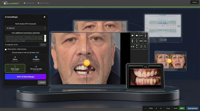 DentalMagic on a computer, a tablet and a phone, showing a before/after smile simulation.